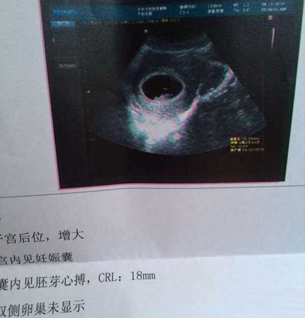 广州如何提升代孕的成功率-专业的代孕_试管移植39天是正常怀孕多少天，从孕